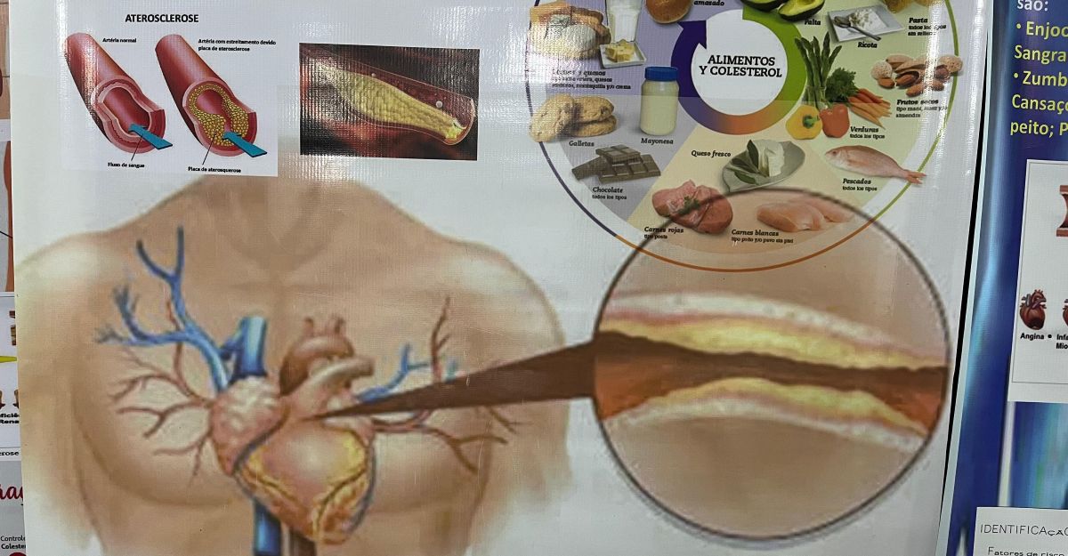 Grupo de Hiperdia CMS MGSF